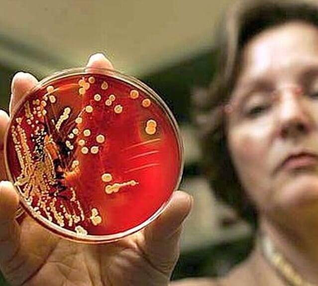 Бактериологический посев на золотистый стафилококк (staphylococcus aureus) с идентификацией микроорганизмов методом времяпролетной масс-спектрометрии (maldi-tof) и определением чувствительности к антибиотикам