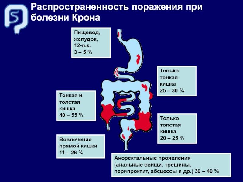Morphological transformation of the intestinal wall in newborns with necrotising enterocolitis | karpova | russian journal of pediatric surgery, anesthesia and intensive care