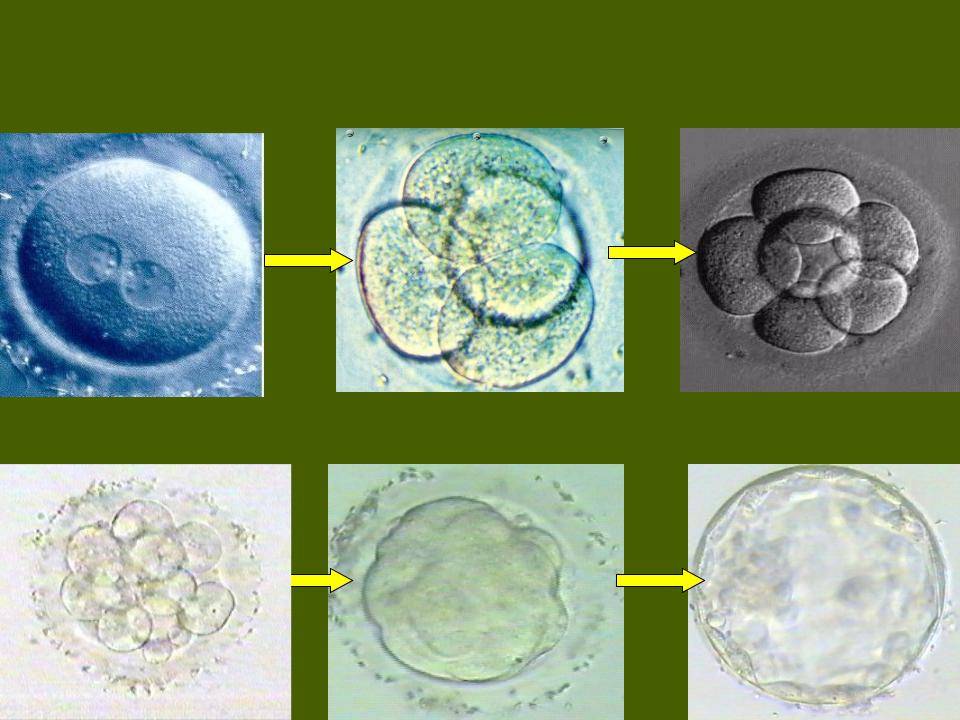 4 оплодотворение. Бластоциста 4аа. Бластоциста эмбрион 5 АА. Бластоциста эмбрион 4 АА. Эмбрион морула на 5.