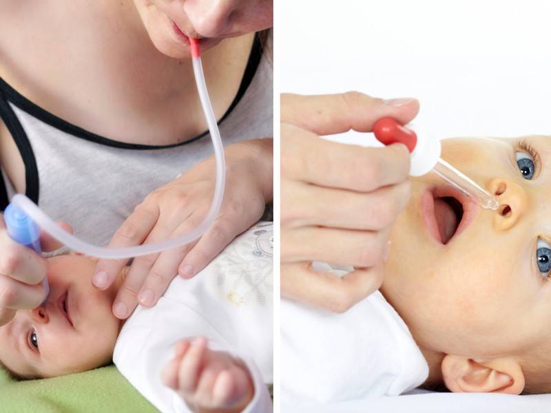 Промывание носа ребенку: как выбрать раствор, какие правила надо соблюдать