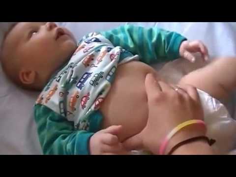 Что делать при кишечных коликах у новорожденных | детская городская поликлиника № 32