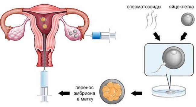 Этапы эко: оценка качества эмбрионов