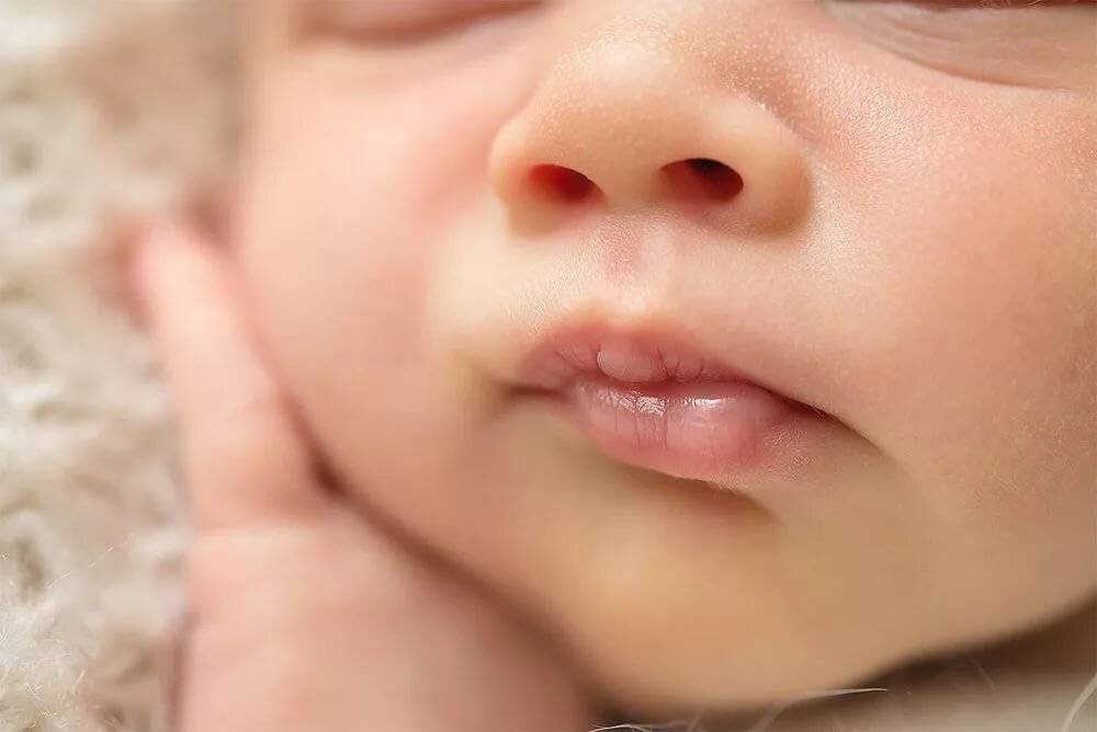 Мозоль на губе у новорожденного: разновидности и симптомы волдырей у ребенка, сосание молока грудничками