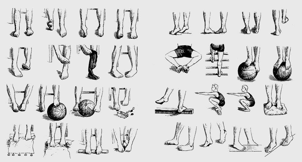 Что родители должны знать о плоскостопии, «косолапии», искривлении ног и обуви? - «доктор гален» консультация ортопеда, травматолога, ревматолога. обследование. лечение. медицинские изделия.