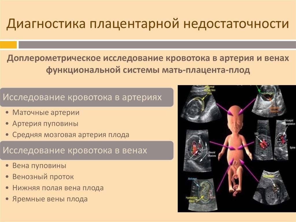 Гестоз при беременности: симптомы, лечение и рекомендации специалиста