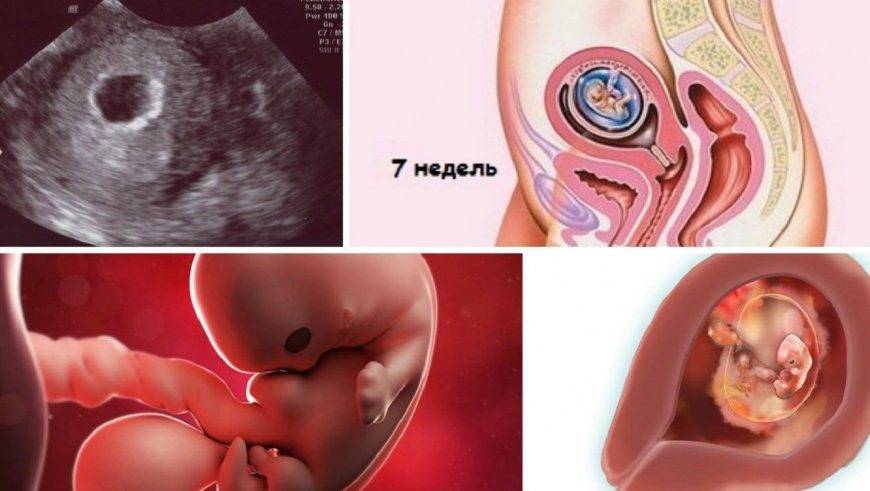 3 недели беременности: что происходит симптомы развитие плода
