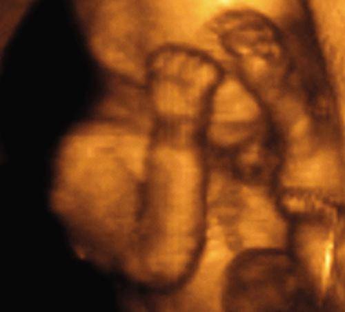 Срок беременности 18 недель — плод, шевеления, выделения, узи, питание, анализы