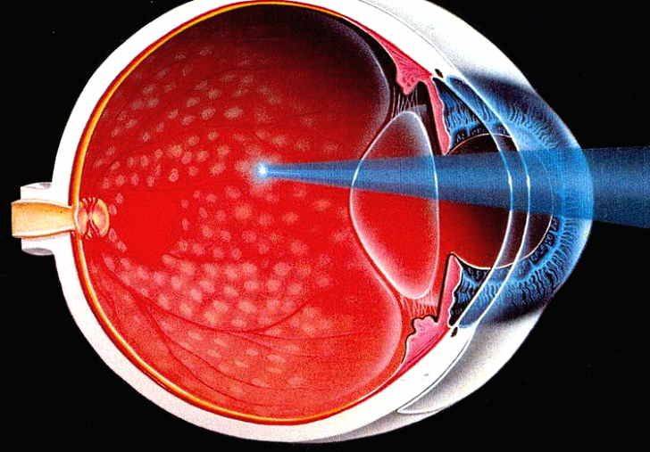 Лечится ли диабетическая ретинопатия народными средствами?