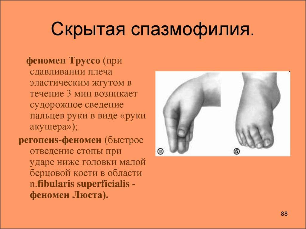 Спазмофилия у детей - симптомы болезни, профилактика и лечение спазмофилии у детей, причины заболевания и его диагностика на eurolab