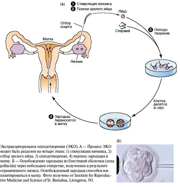 Синдром гиперстимуляции яичников | тонус мама