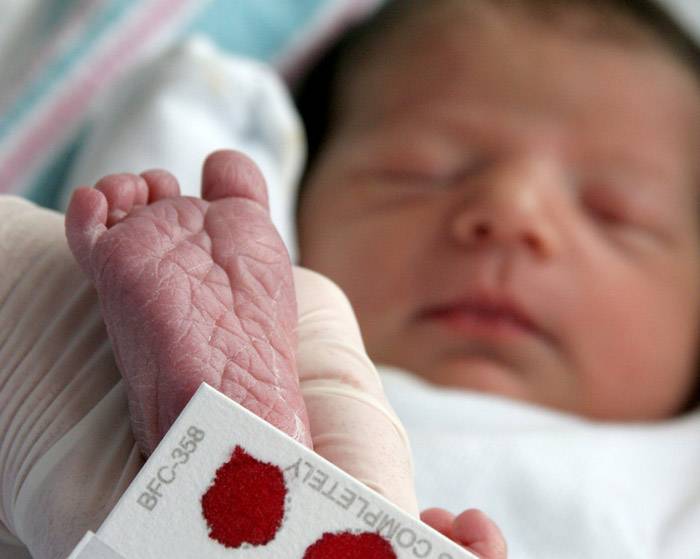 Густая кровь у новорожденных и детей старшего возраста