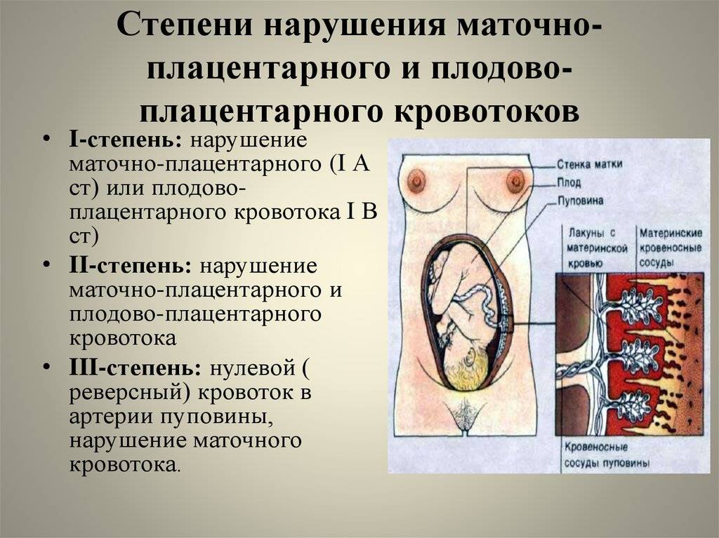 Оценка кровотока в системе мать-плацента-плод