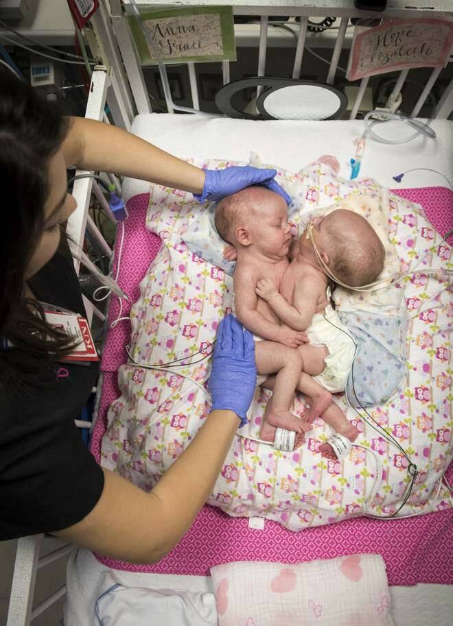 На каком сроке обычно рождается двойня, во сколько недель двойняшки считаются доношенными?