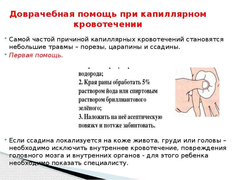 Как остановить сильную кровь. Первая помощь при капиллярном кровотечении. При капиллярном кровотечении. Капиллярное кровотечение. Оказание доврачебной помощи.. Алгоритм оказания первой помощи при ссадинах.