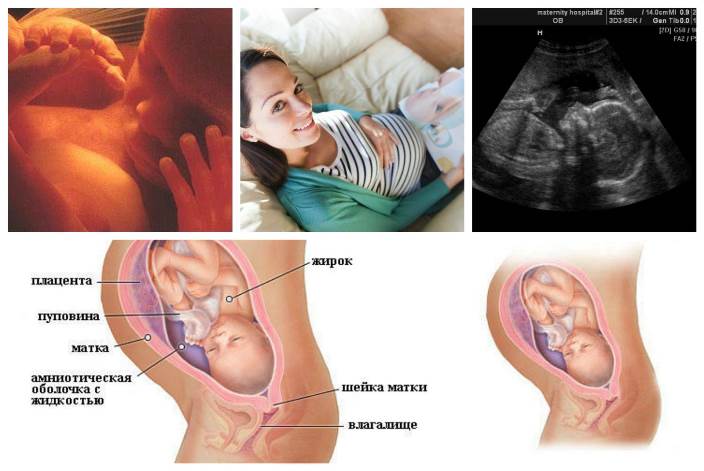 25 неделя беременности. что беспокоит беременную: растяжки и варикоз