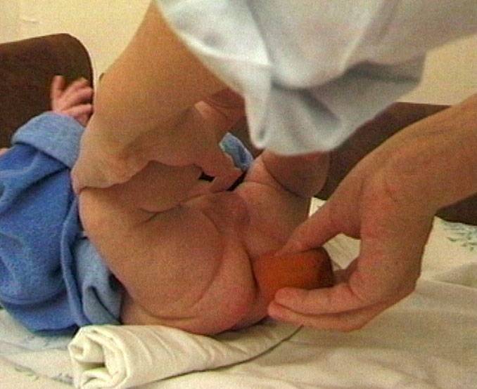 Как правильно сделать клизму новорожденному ребенку