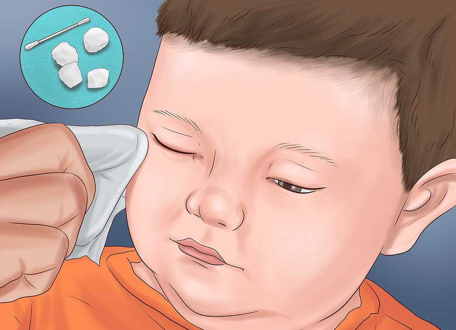 У ребенка в год сопли и кашель: причины и что принимать