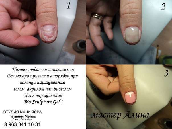 Можно ли беременным наращивать ногти: противопоказания и последствия процедуры