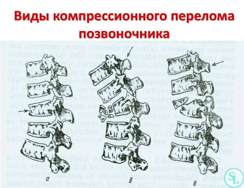 Болезни позвоночника - лечение, симптомы, причины, диагностика | центр дикуля