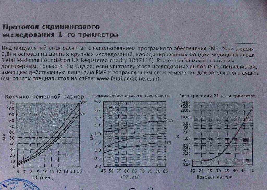 Риск трисомии. Риск трисомии 21 18 13 в 1-м триместре. Риск трисомии 21 в 1-м триместре норма. Риск трисомия 21 в 1 триместре. Риск трисомии норма таблица.