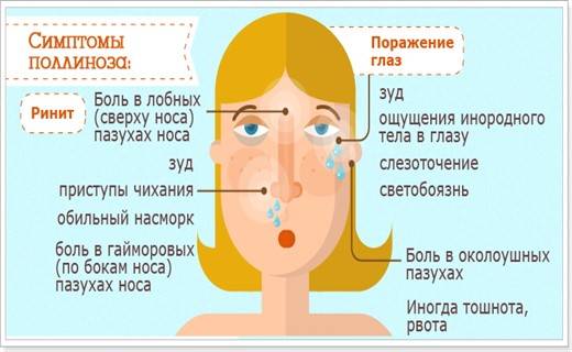Аллергический ринит как одна из граней поллиноза