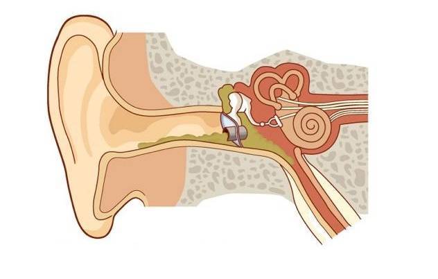 Средний отит (воспаление среднего уха): симптомы и лечение – напоправку – напоправку
