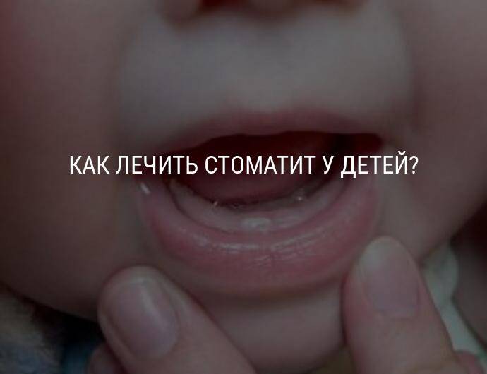 Стоматит Фото Ребенку 3 Года