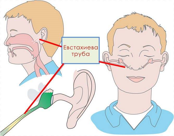 Что делать, если ребенок засунул в ухо посторонний предмет?