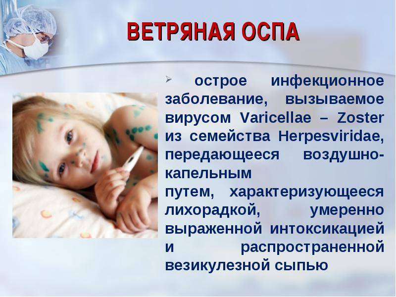 Вакцина от ветрянки спб