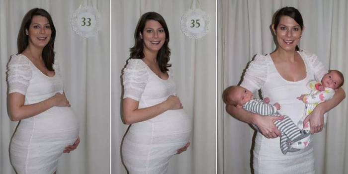 Беременность двойней по неделям. многоплодная беременность, признаки на ранних сроках