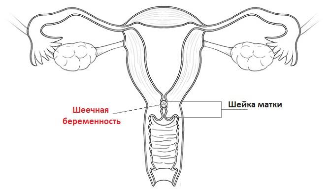 Расшифровка гинекологического узи | университетская клиника