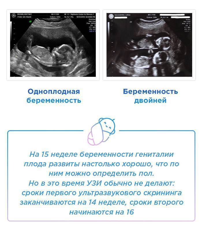На какой неделе можно узнать по узи пол ребенка? 18 фото с 12 недели беременности можно ли определить мальчик это или девочка