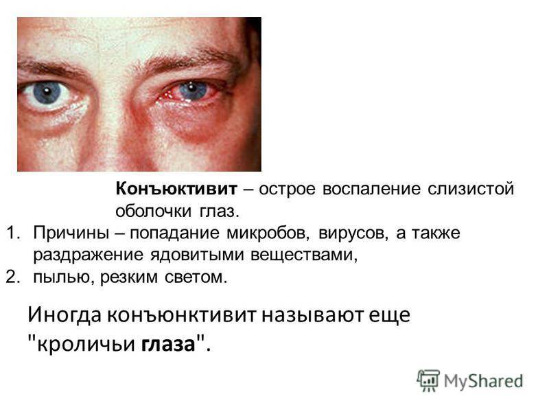 Вирусный конъюнктивит глаз: лечение у детей - энциклопедия ochkov.net