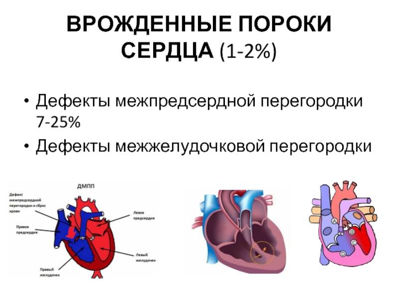 Ультразвуковая семиотика и диагностика в кардиологии детского возраста