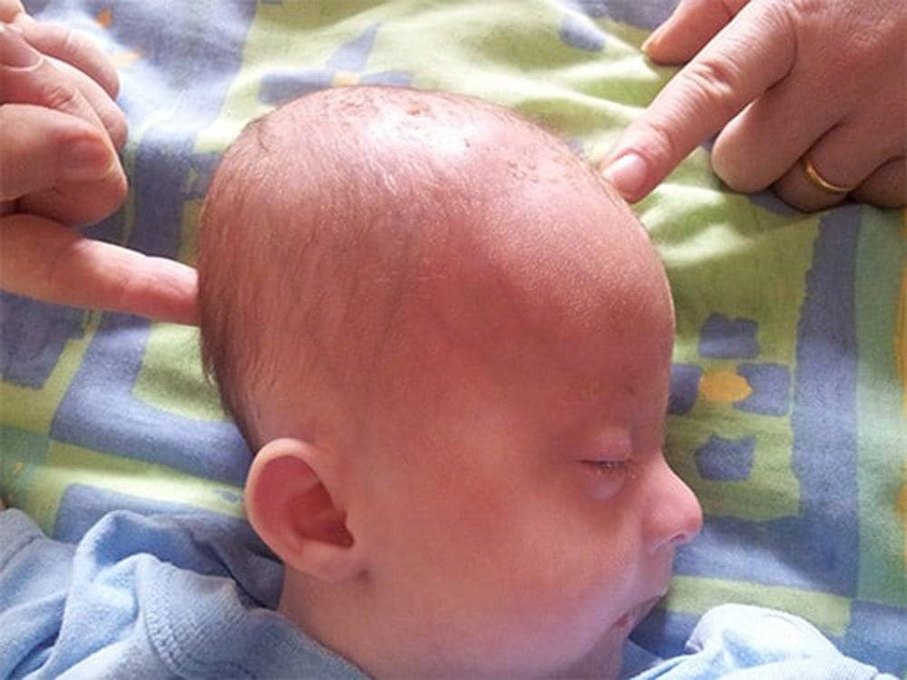Уход за пупком младенца - доказательная медицина для всех