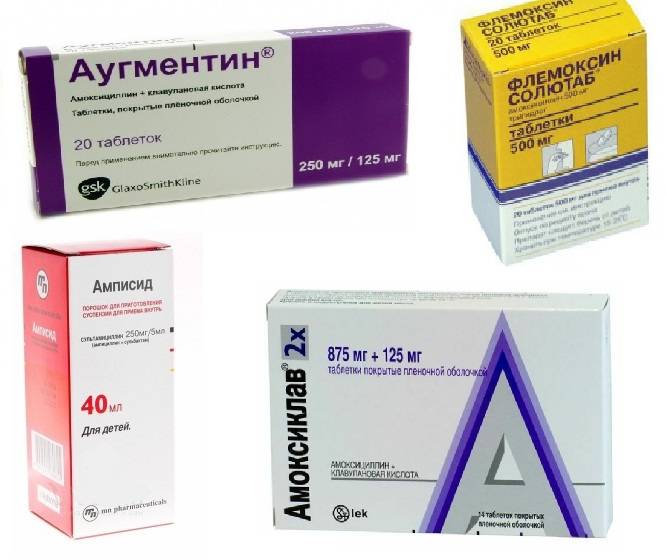 Как лечить отит: нужны ли антибиотики при отите?