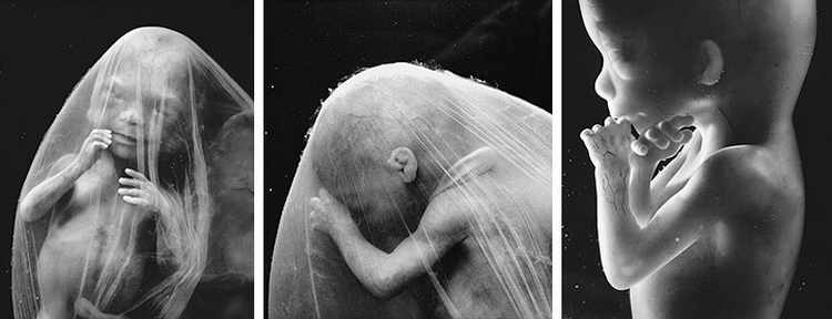 17 неделя беременности: фото живота, узи, развитие ребенка