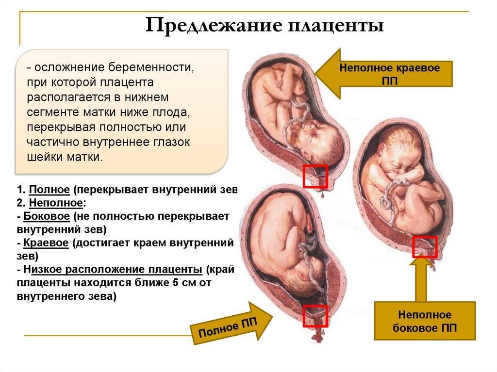 ᐉ формирование плаценты при беременности на какой неделе. что такое плацента. нарушения развития плаценты - ➡ sp-kupavna.ru
