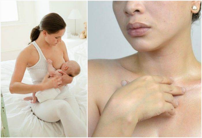 Обвисшая грудь после родов: причины и способы подтяжки