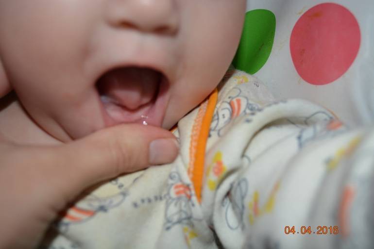 Режутся зубы, как помочь ребенку – лекарства при прорезывании: чем лечить, облегчить и обезболить десны, что делать, дать и как успокоить детей, когда они сильно плачут