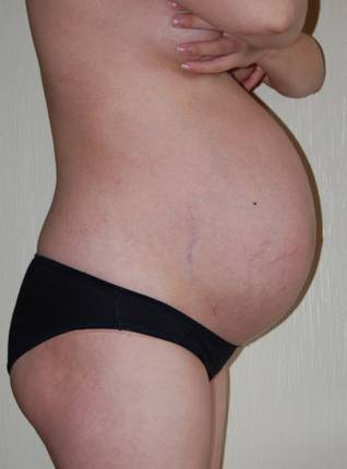 Признаки 40 недель. Небольшие животики у беременных. Живот на 40 неделе беременности. Растяжки на 30 неделе беременности. Беременный живот с растяжками.