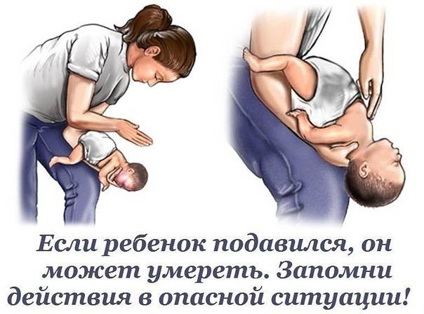 Если ребенок подавился- энциклопедия детское питание