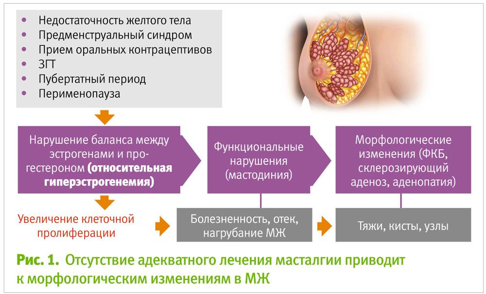 Предменструальное дисфорическое расстройство (пмдр)