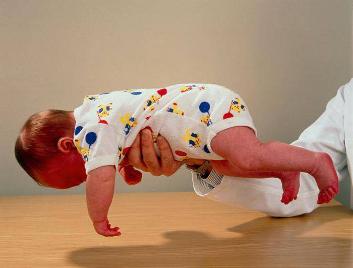 Как распознать гипертонус мышц у младенцев?