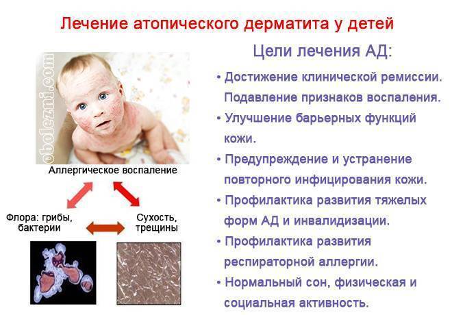 Контактный аллергический дерматит у детей: наиболее частые причины