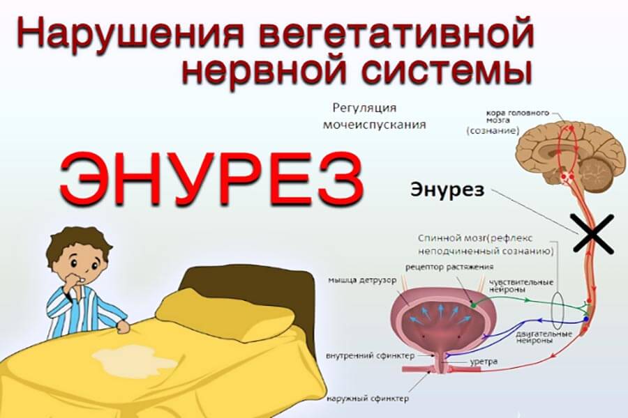 Энурез у ребенка: что это такое, причины, симптомы и способы лечения - московский центр остеопатии
