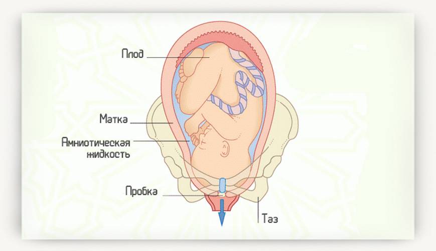 Излитие околоплодных вод у беременных перед родами: как выглядят выделения и как понять, что произошло отхождение?