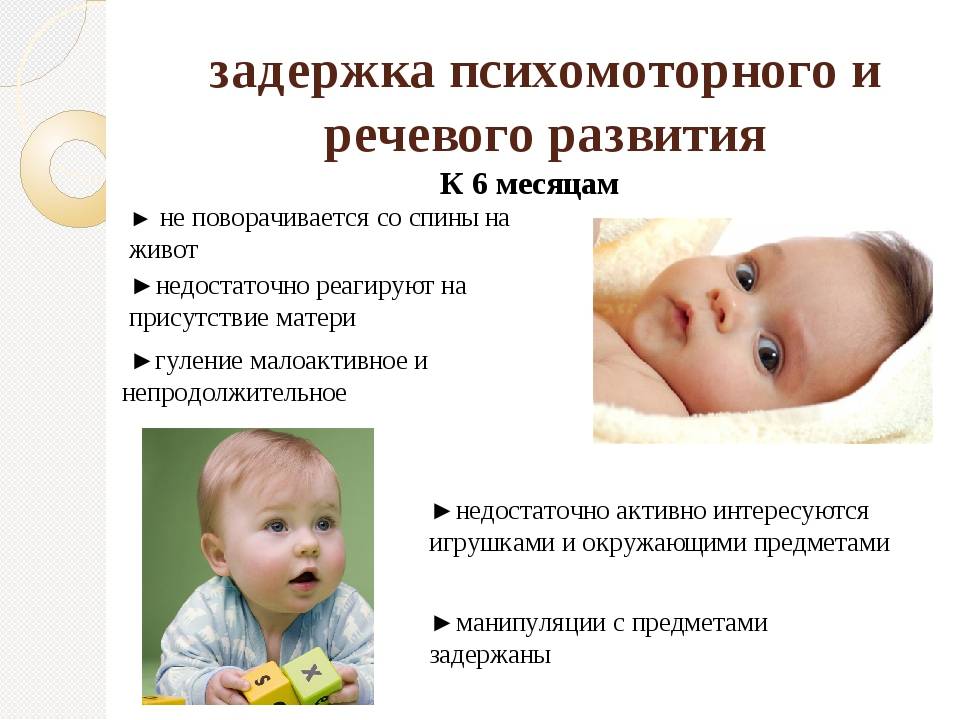 Задержка психомоторного развития у детей