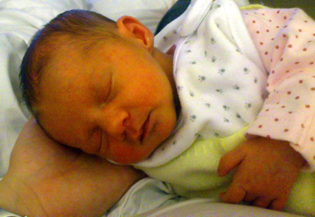 Какие бывают причины патологической желтухи у новорожденных?
