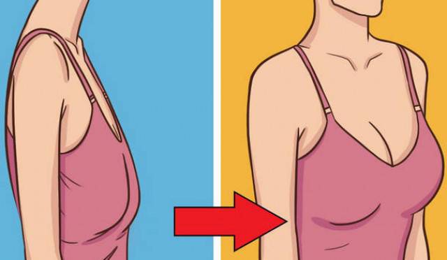 Обвисла грудь: после кормления, после похудения, что делать